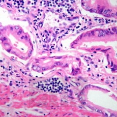   (Mayers hematoxylin)