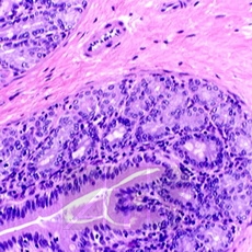   (Harris haematoxylin)