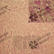   I (Gill`s I haematoxylin)