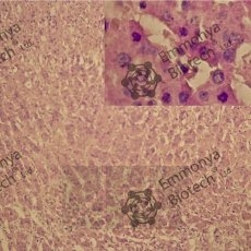   II (Gill`s II haematoxylin)