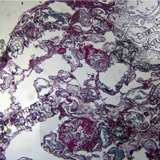    (Weigert Iron haematoxylin)