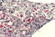    (Weigert Iron haematoxylin)