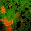    (Stains for microbiology)