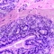   (Harris haematoxylin)