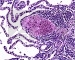   III (Gill`s III haematoxylin)
